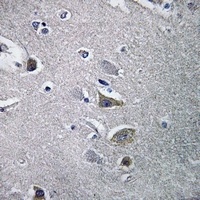 NDUFV2 Rabbit Polyclonal Antibody