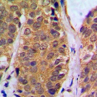 NF-kappaB p105 (Phospho-S927) Antibody