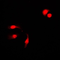 NF-kappaB p105 (Phospho-S927) Antibody