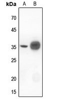 IKB alpha Rabbit Polyclonal Antibody