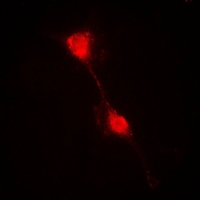 IKB alpha Rabbit Polyclonal Antibody