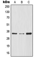 IKB alpha Rabbit Polyclonal Antibody