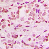 IKB alpha Rabbit Polyclonal Antibody