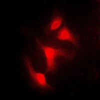 IKB alpha Rabbit Polyclonal Antibody