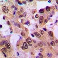IKB beta (Phospho-S23) Antibody