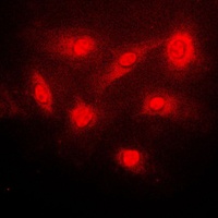 IKB beta (Phospho-S23) Antibody