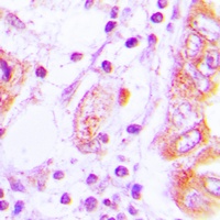 iNOS Rabbit Polyclonal Antibody