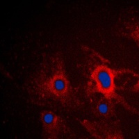 iNOS Rabbit Polyclonal Antibody