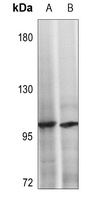 NOTCH2 Rabbit Polyclonal Antibody