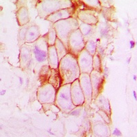 NOTCH2 Rabbit Polyclonal Antibody