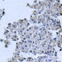 OCRL Rabbit Polyclonal Antibody