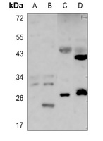 SIX6 Rabbit Polyclonal Antibody