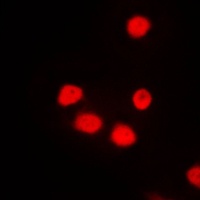 SIX6 Rabbit Polyclonal Antibody