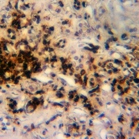 ORC1 Rabbit Polyclonal Antibody
