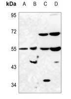 PAH Rabbit Polyclonal Antibody
