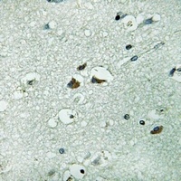 PAH Rabbit Polyclonal Antibody