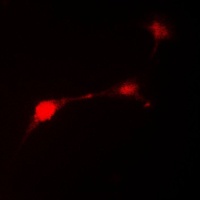 Parkin Rabbit Polyclonal Antibody