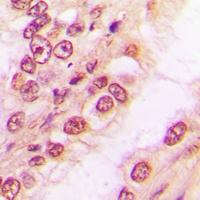 PAWR Antibody