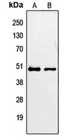 PAX2 Rabbit Polyclonal Antibody