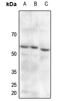 PDPK1 (Phospho-S241) Rabbit Polyclonal Antibody