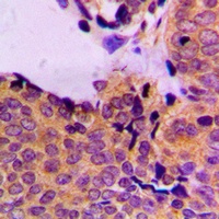 PDPK1 (Phospho-S241) Rabbit Polyclonal Antibody