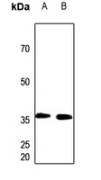 PEX7 Rabbit Polyclonal Antibody