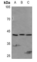 PEX14 Rabbit Polyclonal Antibody