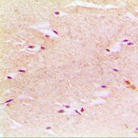 PEX14 Rabbit Polyclonal Antibody