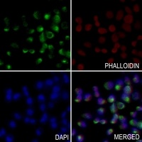 PEX14 Rabbit Polyclonal Antibody