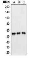 PFKFB1/4 Rabbit Polyclonal Antibody