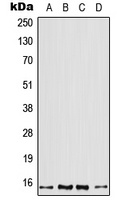Profilin 2 Rabbit Polyclonal Antibody