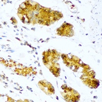 Pepsin A Rabbit Polyclonal Antibody