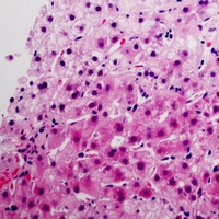 Pepsinogen C Rabbit Polyclonal Antibody