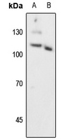 Progesterone Receptor (Phospho-S294) Rabbit Polyclonal Antibody