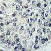 PI3K C2 gamma Rabbit Polyclonal Antibody