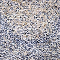 PLC gamma 2 (Phospho-Y1217) Antibody