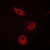 PLC gamma 2 (Phospho-Y1217) Antibody