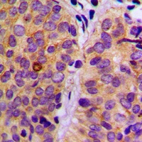 PLC gamma 2 (Phospho-Y753) Antibody
