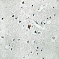 Phospholipase D2 (Phospho-Y169) Antibody