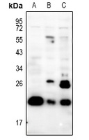 PRRX1 Rabbit Polyclonal Antibody