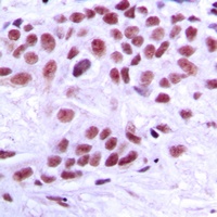 TRAP220 Antibody