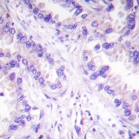 PPP2CA (Phospho-Y307) Antibody