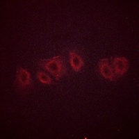 PPP2CA (Phospho-Y307) Antibody
