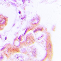 AMPK beta 1 (Phospho-S182) Rabbit Polyclonal Antibody