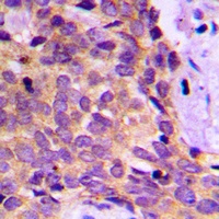 PRKAR1B Rabbit Polyclonal Antibody