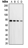 PKC delta (Phospho-T507) Antibody