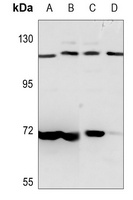 PKN1 Antibody