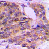 PKC theta (Phospho-S676) Antibody