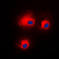 PKC theta (Phospho-S676) Antibody