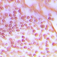DNA-PKcs Rabbit Polyclonal Antibody